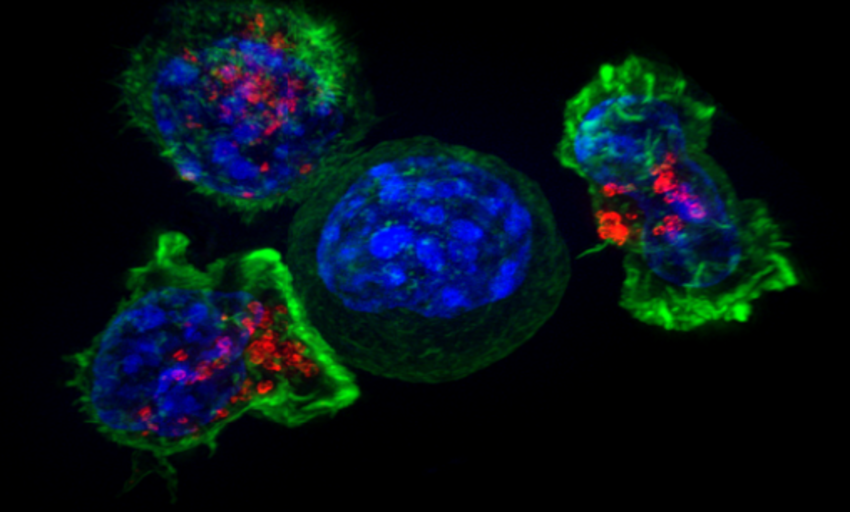  ¿Qué tienen en común una célula tumoral cultivada con la de un cáncer? Muy poco