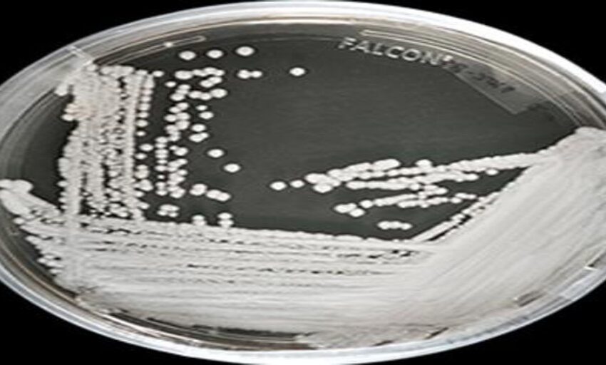  EE.UU. registra dos brotes del peligroso hongo Candida auris resistente a todos los medicamentos