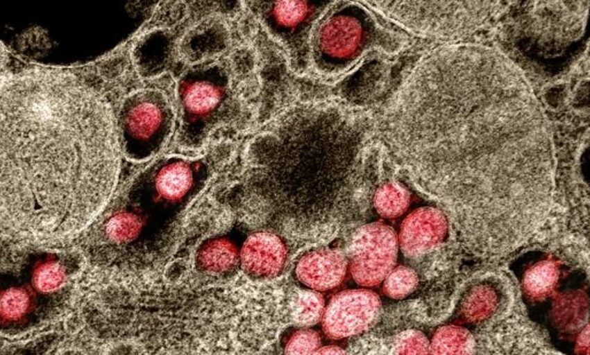  Un mal control del VIH favorece la creación de nuevas variantes del coronavirus