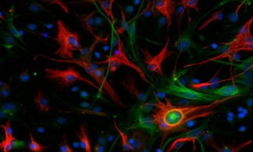 Investigadores del CNIO descubren el «interruptor» genético general del cáncer cerebral con peor pronóstico