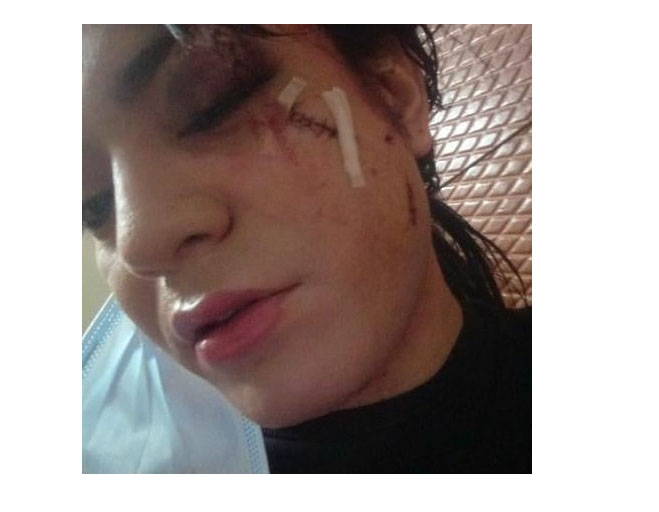  La víctima está «muy afectada por el brutal ataque sufrido» y espera que los agresores «paguen» por el daño