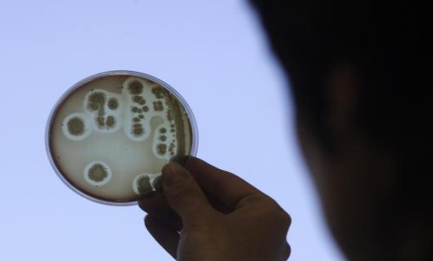  Las bacterias superresistentes mataron en 2019 a más personas que el cáncer y el sida juntos