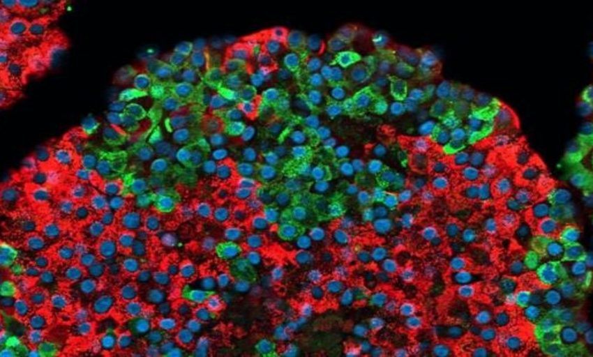  El tratamiento de la diabetes con células madre ya no es ciencia ficción