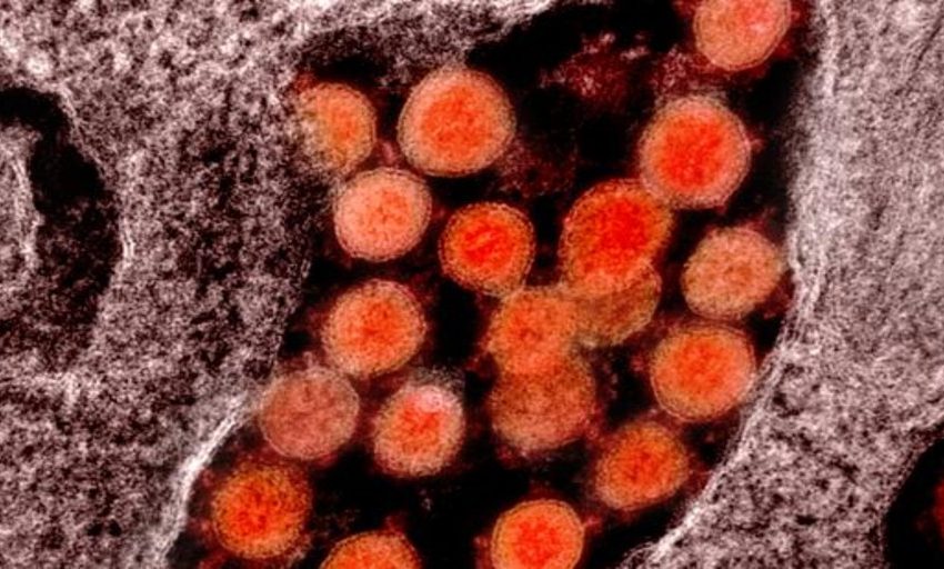  Hallan restos de coronavirus en heces humanas hasta 7 meses después de la infección