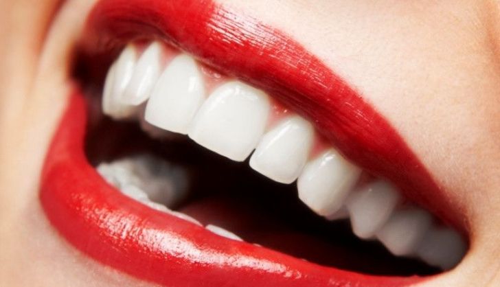  La sensibilidad dental podría deberse a estos factores