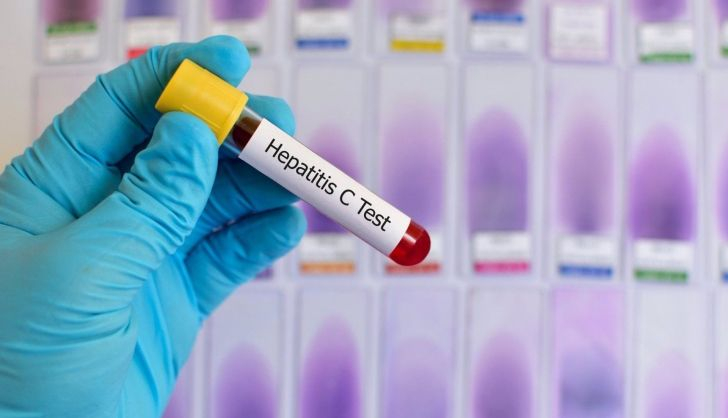  La OMS recomienda simplificar la atención para acceder a pruebas y tratamientos de la hepatitis C