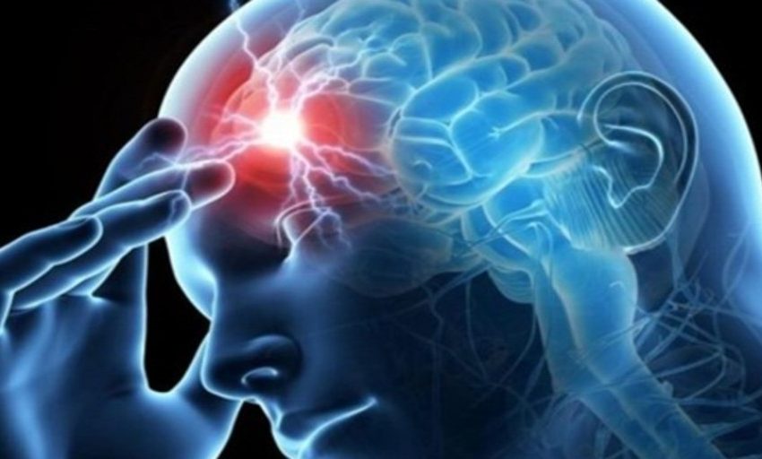  ¿Cefalea o migraña? Aprende a diferenciar tu dolor de cabeza