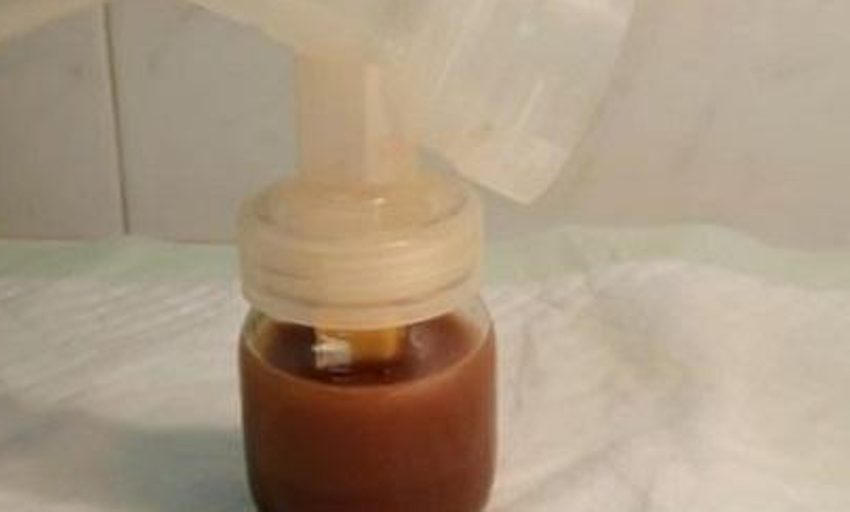  Síndrome de las tuberías oxidadas: ¿por qué la leche materna puede ser marrón?