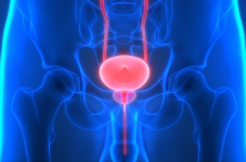  Prostatitis, una infección frecuente de la próstata: por qué sucede y consejos para cuidar la próstata en el día a día