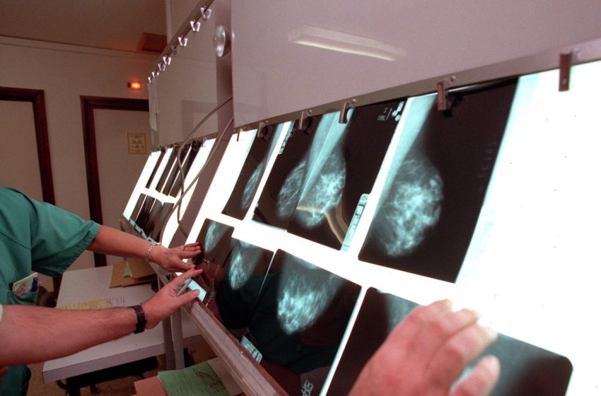  Investigadores españoles crean un modelo para predecir el riesgo individual de cáncer de mama