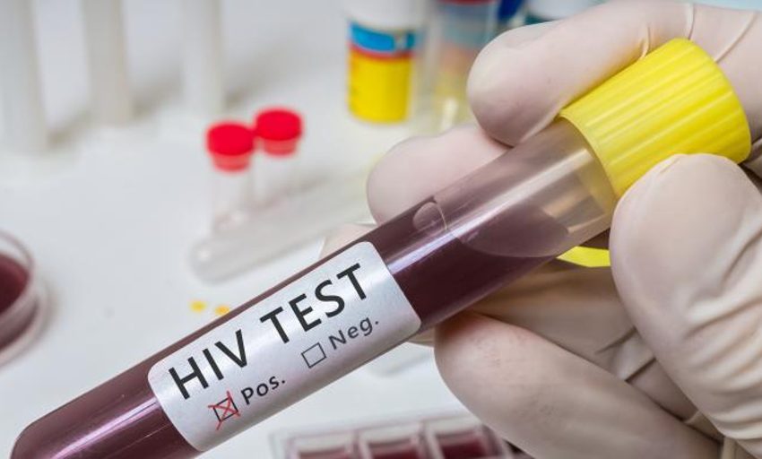  Disponible en España un nuevo tratamiento para el VIH: un pinchazo seis veces al año