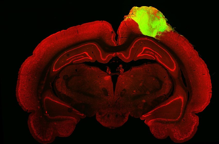  Un trasplante de tejidos cerebrales devuelve la visión a ratas ciegas