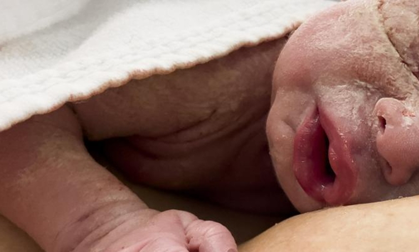  Asocian nacer por parto inducido con un peor rendimiento académico