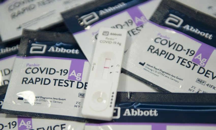  Sanidad retira un conocido test de antígenos de las farmacias por estar contaminado