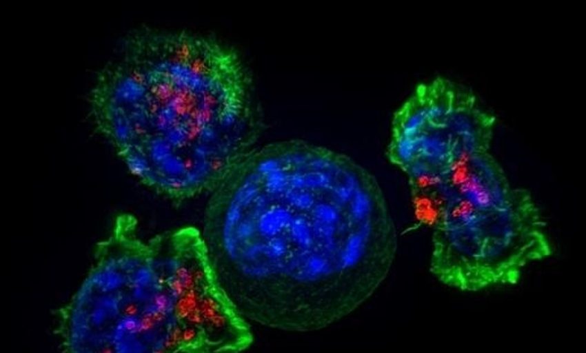  Una nueva combinación de terapias retrasa el avance del cáncer de ovario