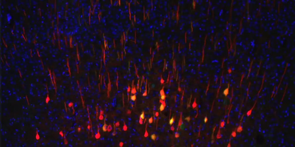  Este biomarcador predice qué neuronas se regenerarán