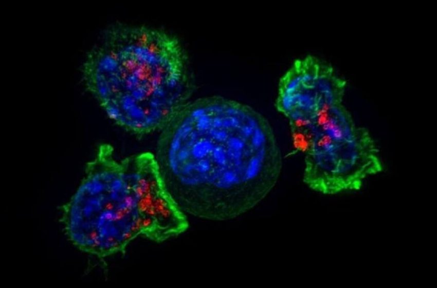  Esta debilidad en las células del cáncer del páncreas permite eliminar el tumor