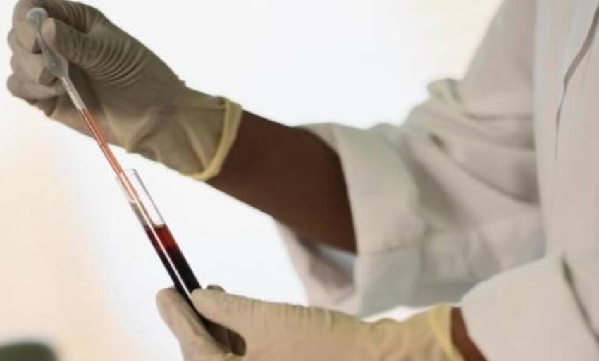  Un test de sangre personaliza y mejora la terapia para la leucemia más común
