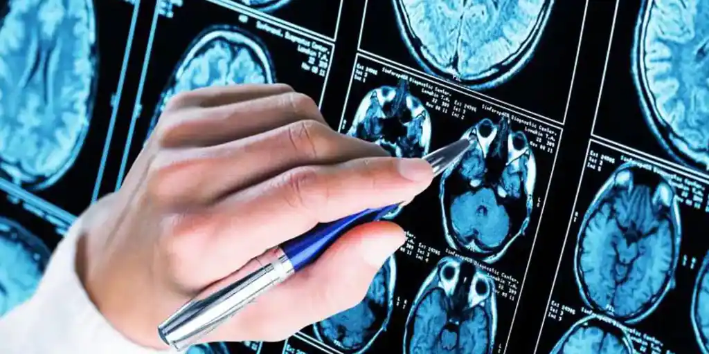  Un nuevo test de sangre permite detectar con antelación el alzhéimer