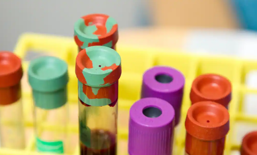  Un test detectar 18 tipos diferentes de cáncer en las fases más tempranas