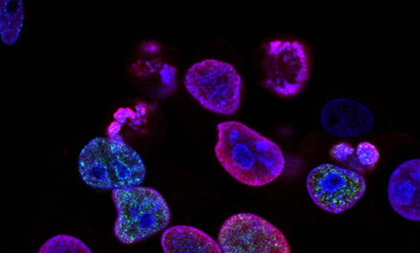  Una técnica caza las células del cáncer para que el sistema inmune las elimine