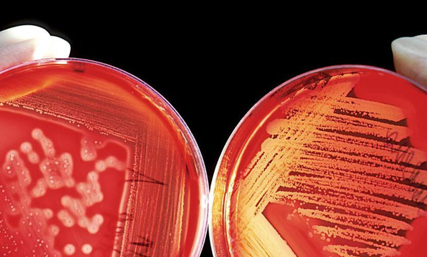  Diseñan un fármaco ‘superasesino’ para combatir las bacterias multirresistentes